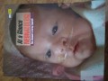 At A Glance Neonatologi
